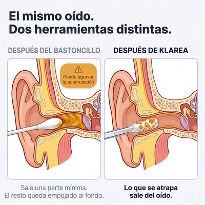 Klarea Pro® Limpiador de oídos adhesivo