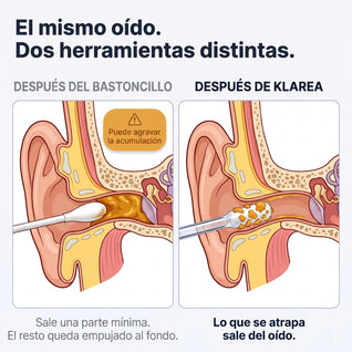 Klarea Pro® Limpiador de oídos adhesivo