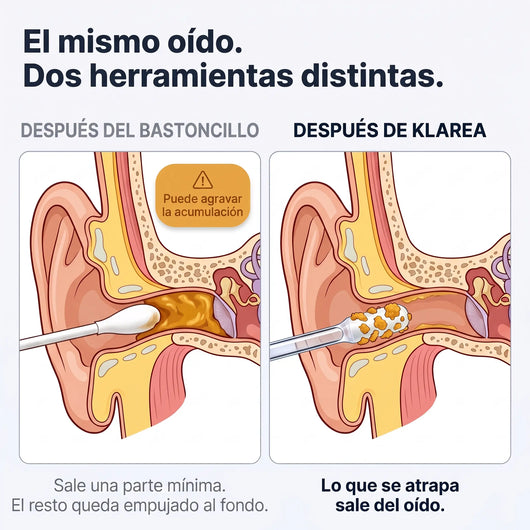 Klarea Pro® Limpiador de oídos adhesivo